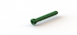 2.4mm   Locking Cortical Screws