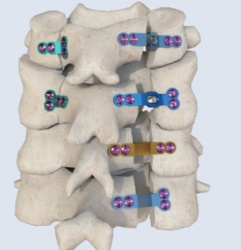 Cervical spine door opening plate