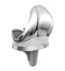 Knee Joint replacement prosthesis